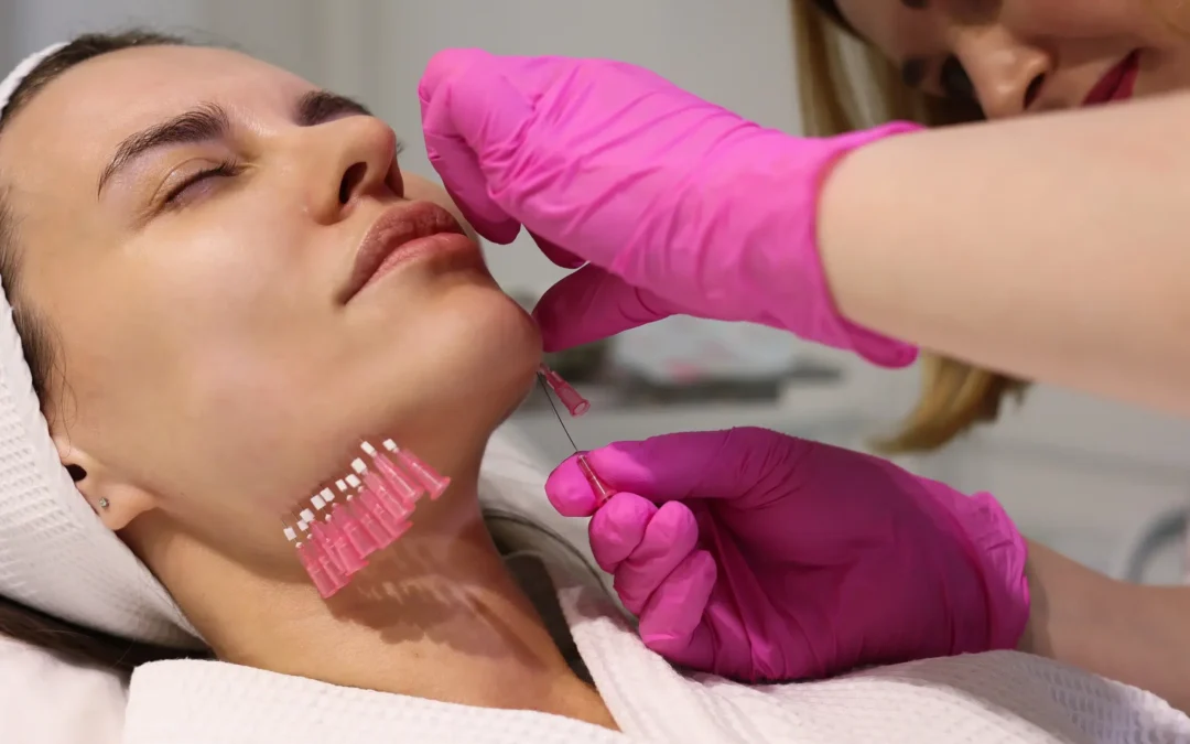 Instalift procedure